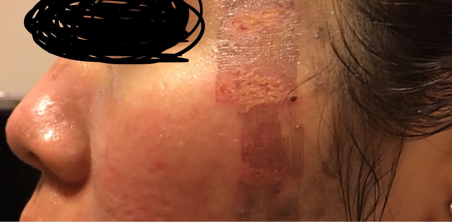 心得 反推極光美學 飛梭失敗差點毀容 Mo Ptt 鄉公所